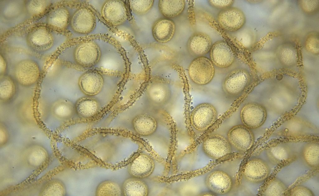 Perichaena depressa?